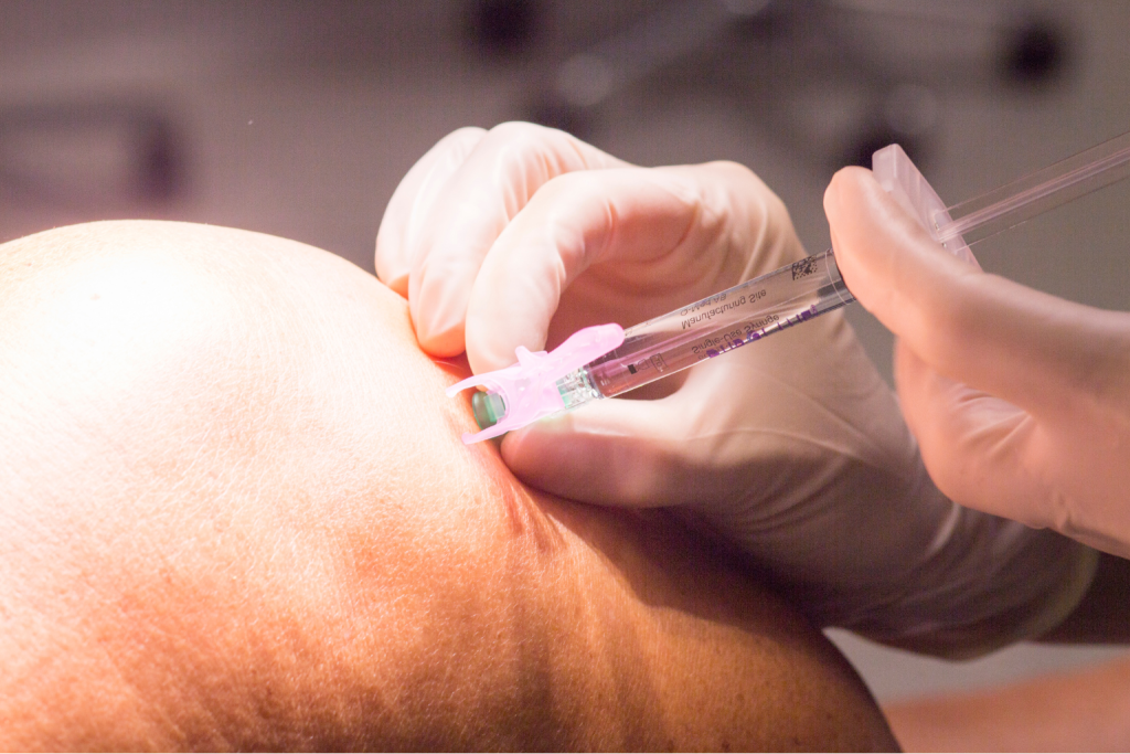 local anaesthetic
