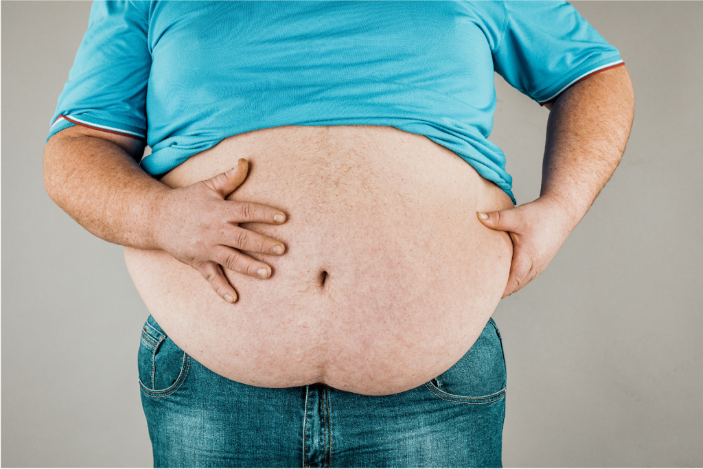 obese person