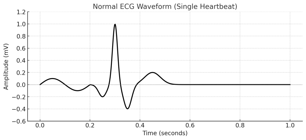 Normal ECG Waveform (Single Heartbeat)